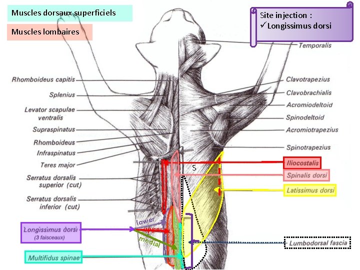 Muscles dorsaux superficiels Site injection : üLongissimus dorsi Muscles lombaires S lower upper med