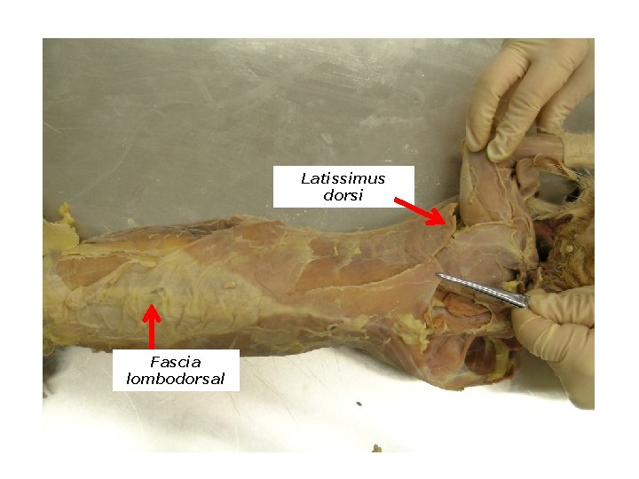 Latissimus dorsi Fascia lombodorsal 