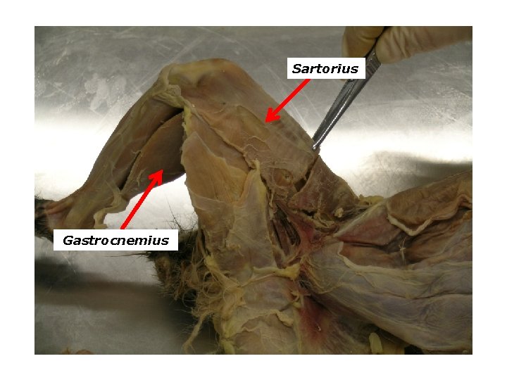 Sartorius Gastrocnemius 