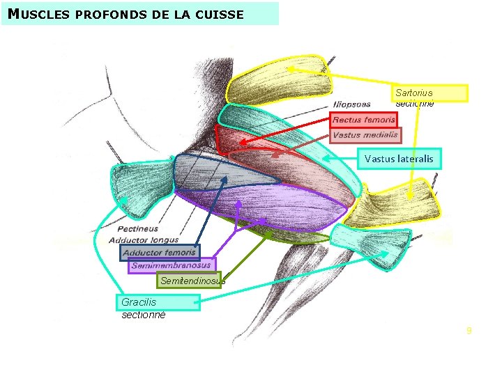 MUSCLES PROFONDS DE LA CUISSE Sartorius sectionné Vastus lateralis Semitendinosus Gracilis sectionné - Dissection