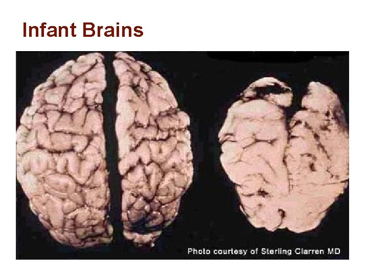 Infant Brains 