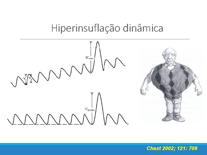 Hiperinsuflação dinâmica Chest 2002; 121: 708 