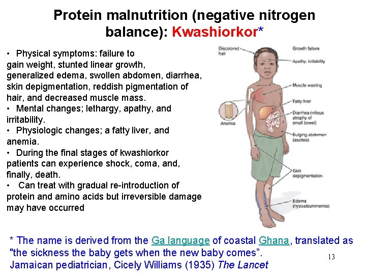 Protein malnutrition (negative nitrogen balance): Kwashiorkor* • Physical symptoms: failure to gain weight, stunted