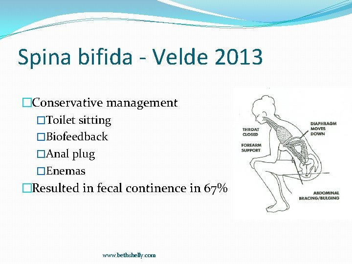 Spina bifida - Velde 2013 �Conservative management �Toilet sitting �Biofeedback �Anal plug �Enemas �Resulted