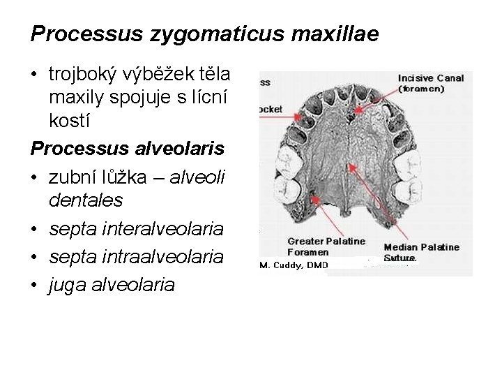 Processus zygomaticus maxillae • trojboký výběžek těla maxily spojuje s lícní kostí Processus alveolaris