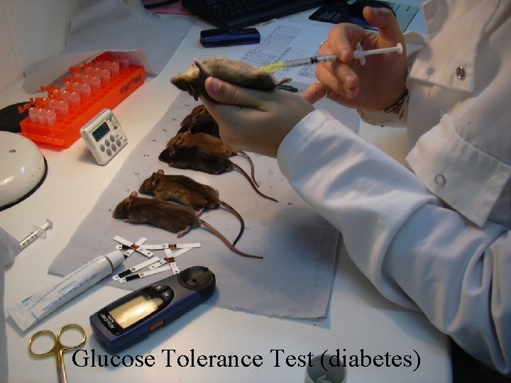 Glucose Tolerance Test (diabetes) 