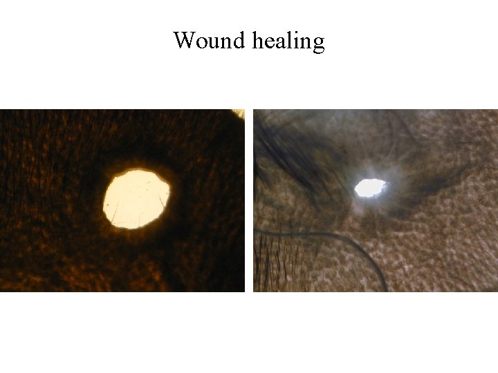 Wound healing 