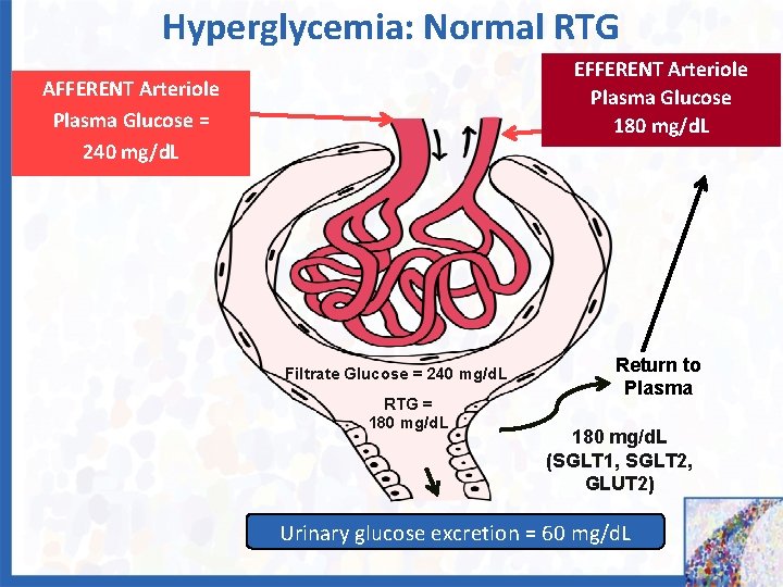 Hyperglycemia: Normal RTG EFFERENT Arteriole Plasma Glucose 180 mg/d. L AFFERENT Arteriole Plasma Glucose