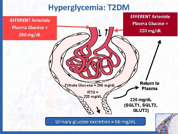 Hyperglycemia: T 2 DM EFFERENT Arteriole Plasma Glucose = 220 mg/d. L AFFERENT Arteriole