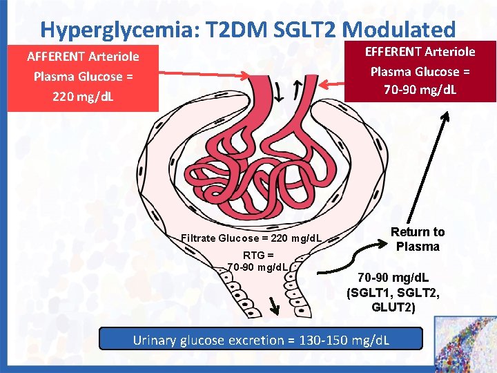 Hyperglycemia: T 2 DM SGLT 2 Modulated EFFERENT Arteriole Plasma Glucose = 70 -90
