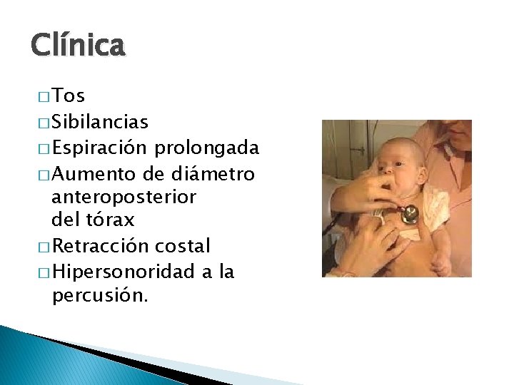 Clínica � Tos � Sibilancias � Espiración prolongada � Aumento de diámetro anteroposterior del