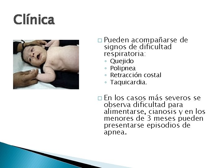 Clínica � Pueden acompañarse de signos de dificultad respiratoria: ◦ ◦ Quejido Polipnea Retracción