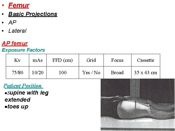  • Femur • Basic Projections • AP • Lateral AP femur Exposure Factors