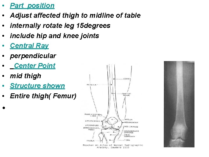  • • • Part position Adjust affected thigh to midline of table internally