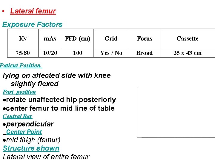  • Lateral femur Exposure Factors Kv m. As FFD (cm) Grid Focus Cassette