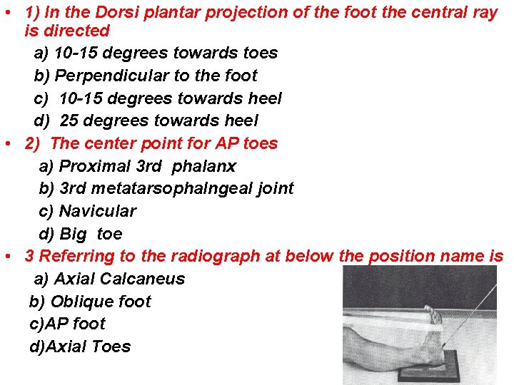  • 1) In the Dorsi plantar projection of the foot the central ray