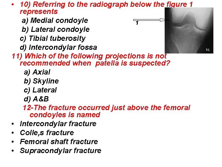  • 10) Referring to the radiograph below the figure 1 represents a) Medial