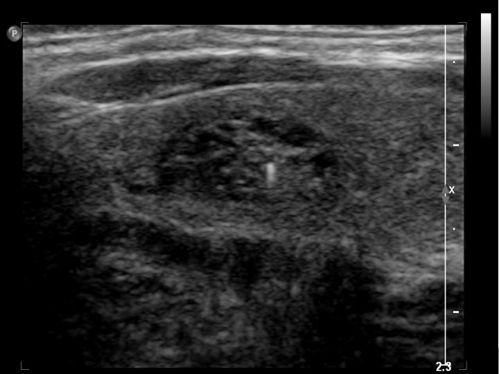 Insert colloid pix Insert colloid pix