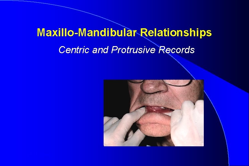 Maxillo-Mandibular Relationships Centric and Protrusive Records Robert W. Loney 