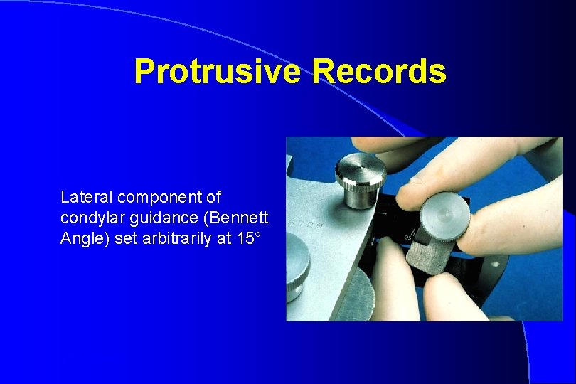 Protrusive Records Lateral component of condylar guidance (Bennett Angle) set arbitrarily at 15° Robert