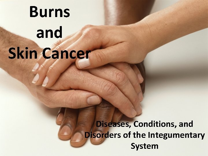 Burns and Skin Cancer Diseases, Conditions, and Disorders of the Integumentary System 