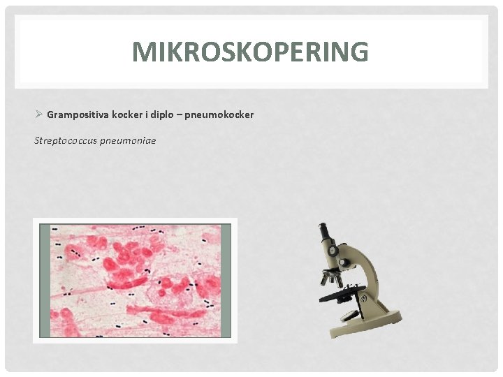 MIKROSKOPERING Ø Grampositiva kocker i diplo – pneumokocker Streptococcus pneumoniae 