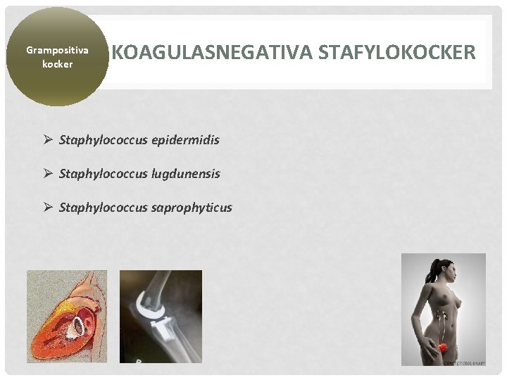 Grampositiva kocker KOAGULASNEGATIVA STAFYLOKOCKER Ø Staphylococcus epidermidis Ø Staphylococcus lugdunensis Ø Staphylococcus saprophyticus 