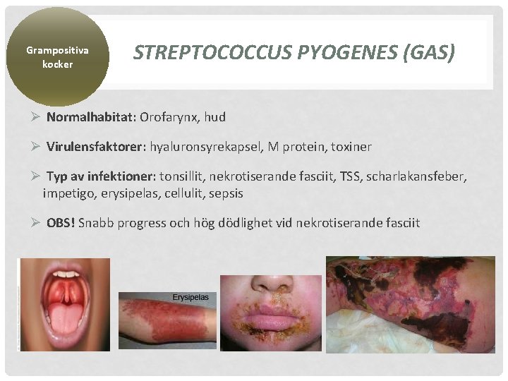 Grampositiva kocker STREPTOCOCCUS PYOGENES (GAS) Ø Normalhabitat: Orofarynx, hud Ø Virulensfaktorer: hyaluronsyrekapsel, M protein,