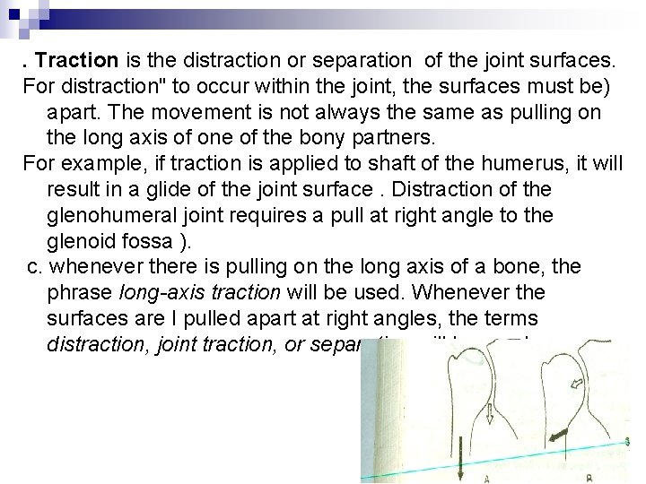 . Traction is the distraction or separation of the joint surfaces. For distraction" to