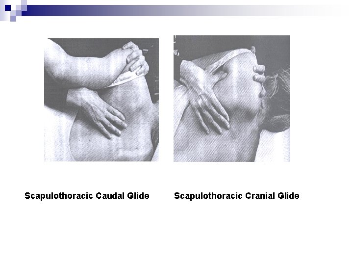 Scapulothoracic Caudal Glide Scapulothoracic Cranial Glide 