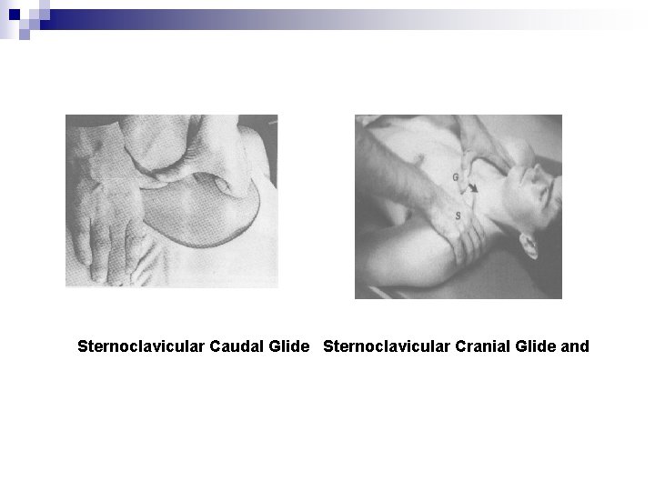 Sternoclavicular Caudal Glide Sternoclavicular Cranial Glide and 