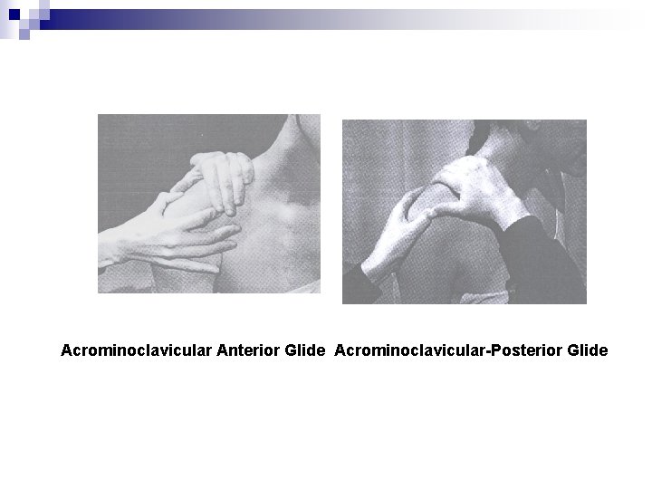 Acrominoclavicular Anterior Glide Acrominoclavicular Posterior Glide 