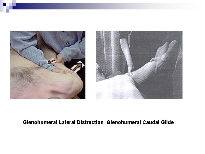 Glenohumeral Lateral Distraction Glenohumeral Caudal Glide 