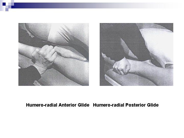 Humero radial Anterior Glide Humero radial Posterior Glide 