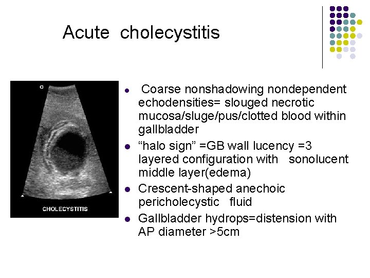 Acute cholecystitis l l Coarse nonshadowing nondependent echodensities= slouged necrotic mucosa/sluge/pus/clotted blood within gallbladder