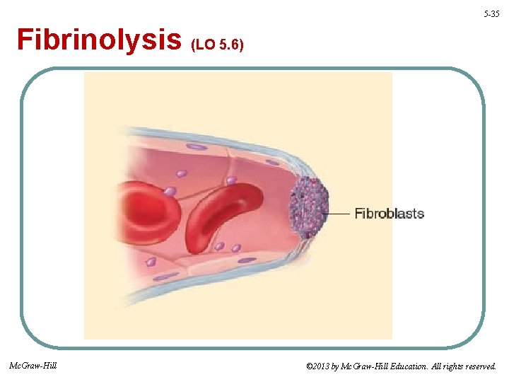 5 -35 Fibrinolysis (LO 5. 6) Mc. Graw-Hill © 2013 by Mc. Graw-Hill Education.