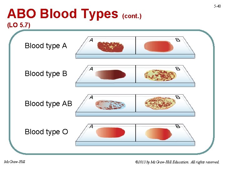 ABO Blood Types (cont. ) 5 -40 (LO 5. 7) Blood type A Blood