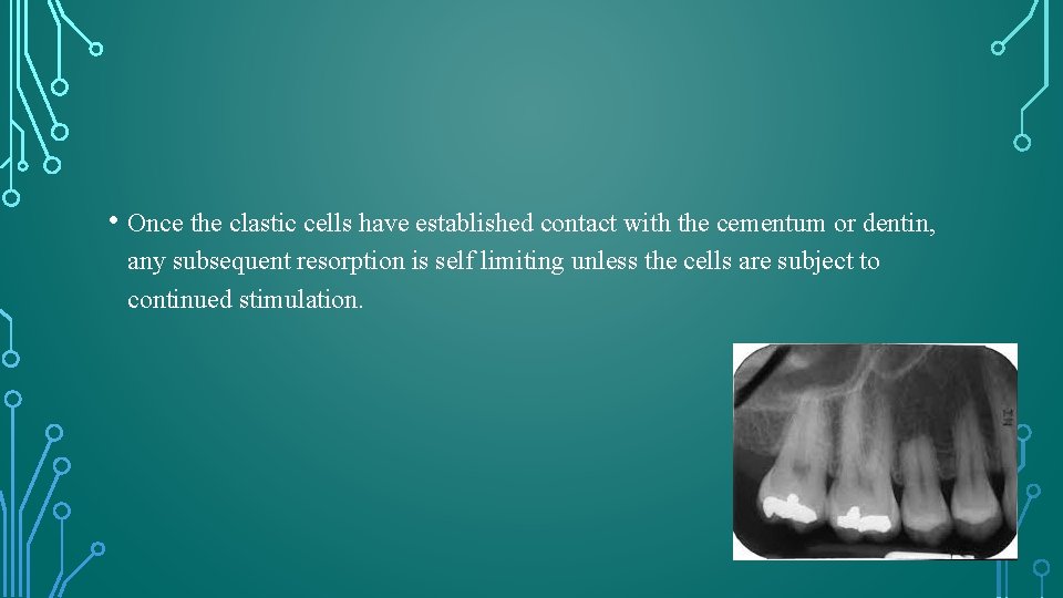  • Once the clastic cells have established contact with the cementum or dentin,