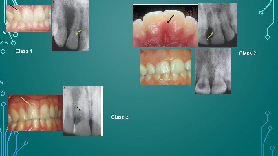 Class 1 Class 2 Class 3 