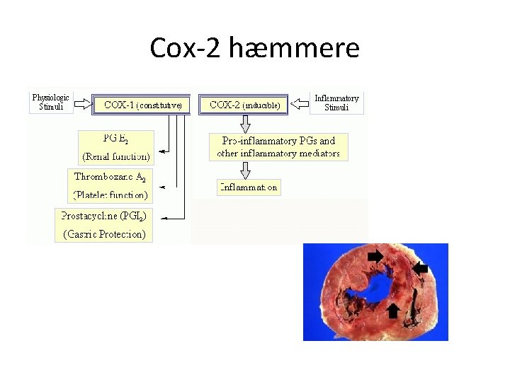 Cox-2 hæmmere 