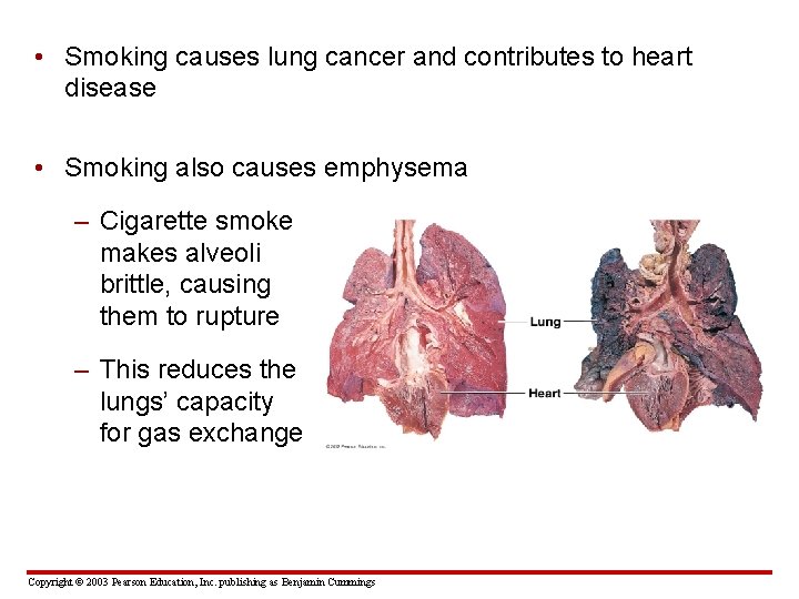  • Smoking causes lung cancer and contributes to heart disease • Smoking also