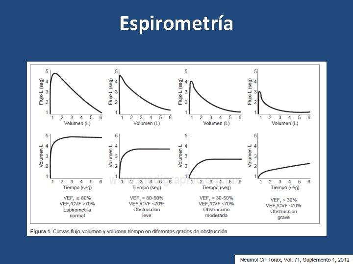 Espirometría 