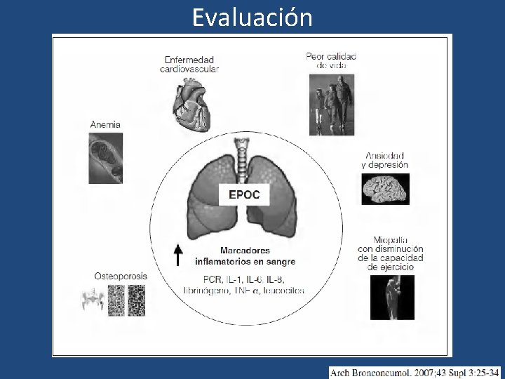 Evaluación 