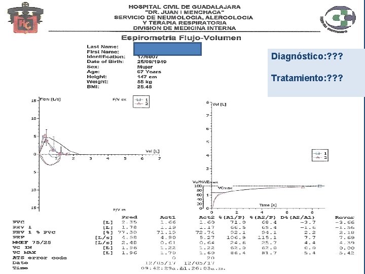 Diagnóstico: ? ? ? Tratamiento: ? ? ? 