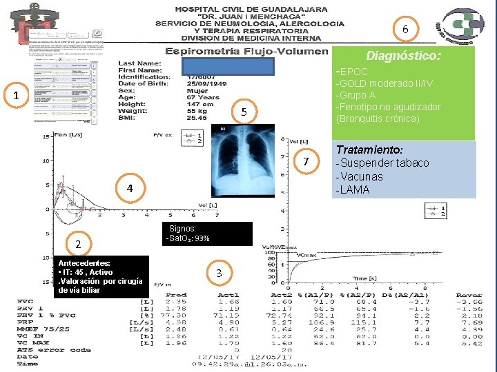 6 Diagnóstico: -EPOC Diagnóstico: ? ? ? 1 5 -GOLD moderado II/IV -Grupo A