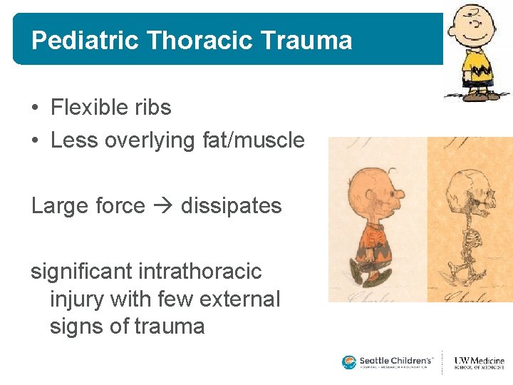 Pediatric Thoracic Trauma • Flexible ribs • Less overlying fat/muscle Large force dissipates significant Pediatric Thoracic Trauma • Flexible ribs • Less overlying fat/muscle Large force dissipates significant