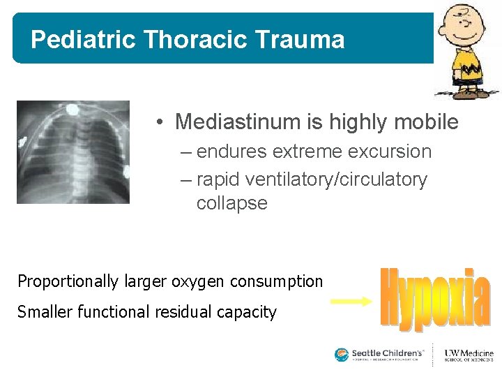 Pediatric Thoracic Trauma • Mediastinum is highly mobile – endures extreme excursion – rapid Pediatric Thoracic Trauma • Mediastinum is highly mobile – endures extreme excursion – rapid