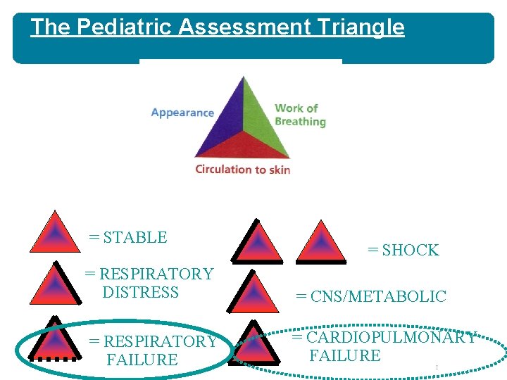 The Pediatric Assessment Triangle = STABLE = SHOCK = RESPIRATORY DISTRESS = CNS/METABOLIC = The Pediatric Assessment Triangle = STABLE = SHOCK = RESPIRATORY DISTRESS = CNS/METABOLIC =