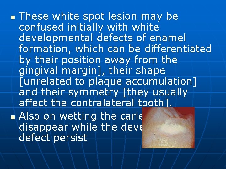 n n These white spot lesion may be confused initially with white developmental defects