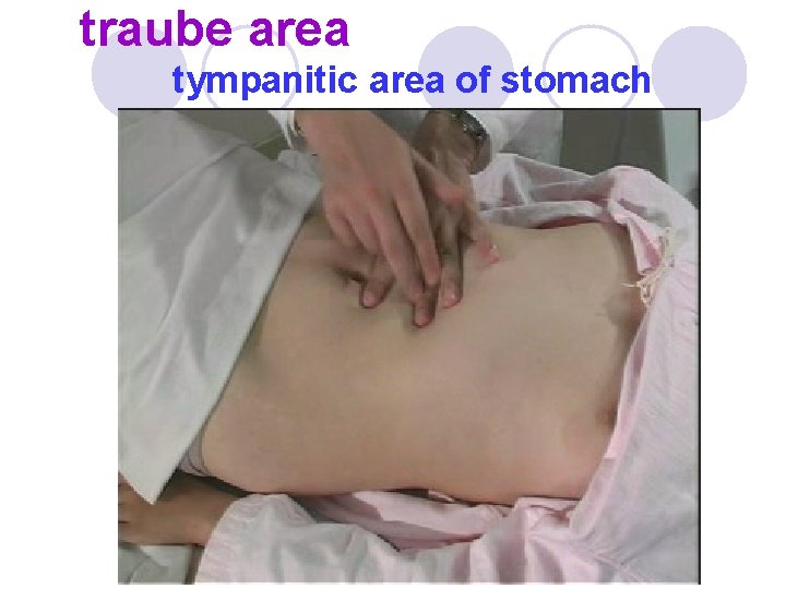 traube area tympanitic area of stomach 